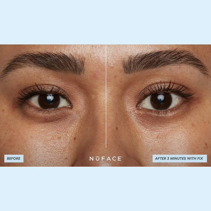 Nuface IonPlex Hydra - Gel Power Eye Patches 30pc - Beauty Tribe